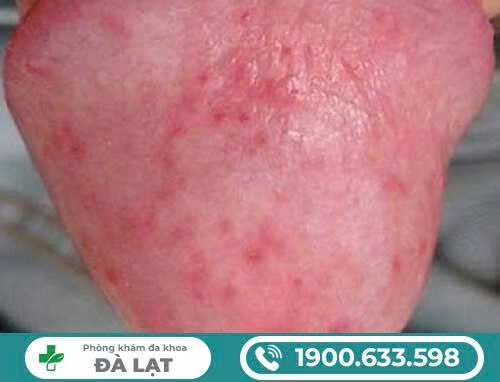 Hình ảnh minh họa